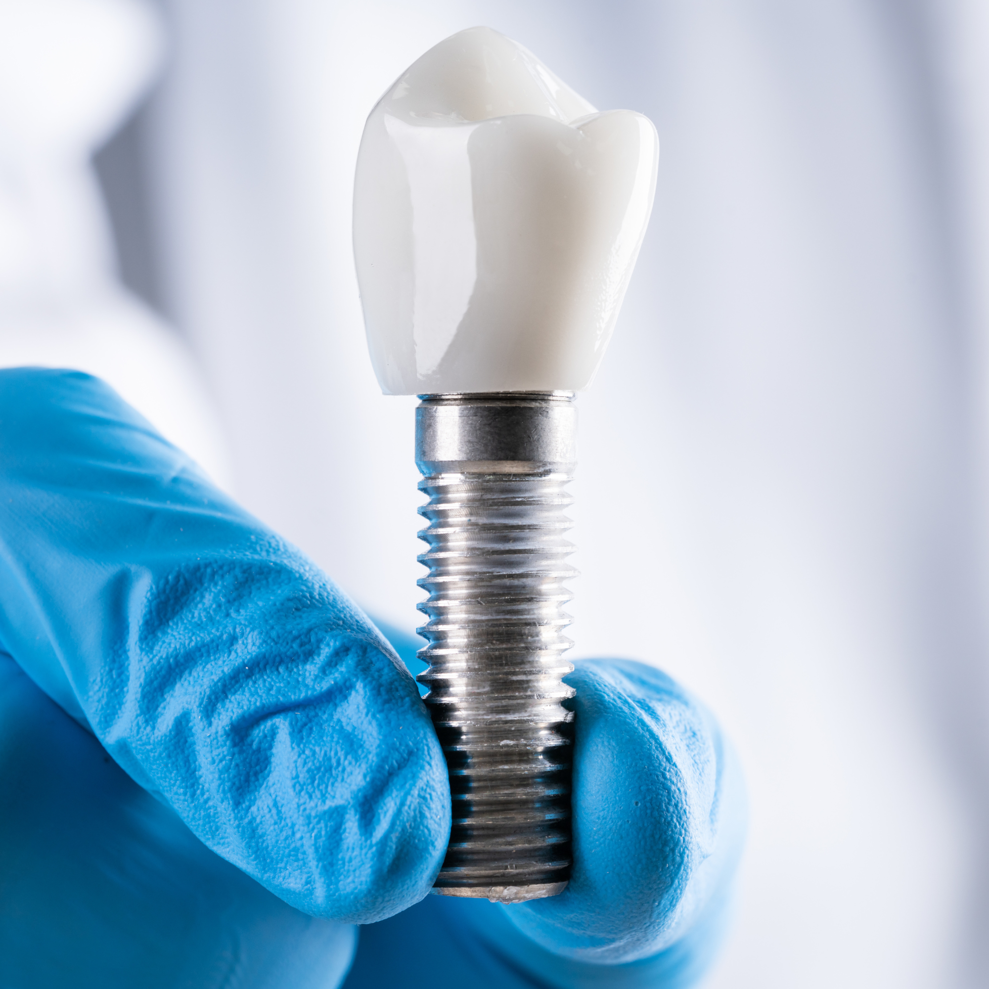 Implant diagram