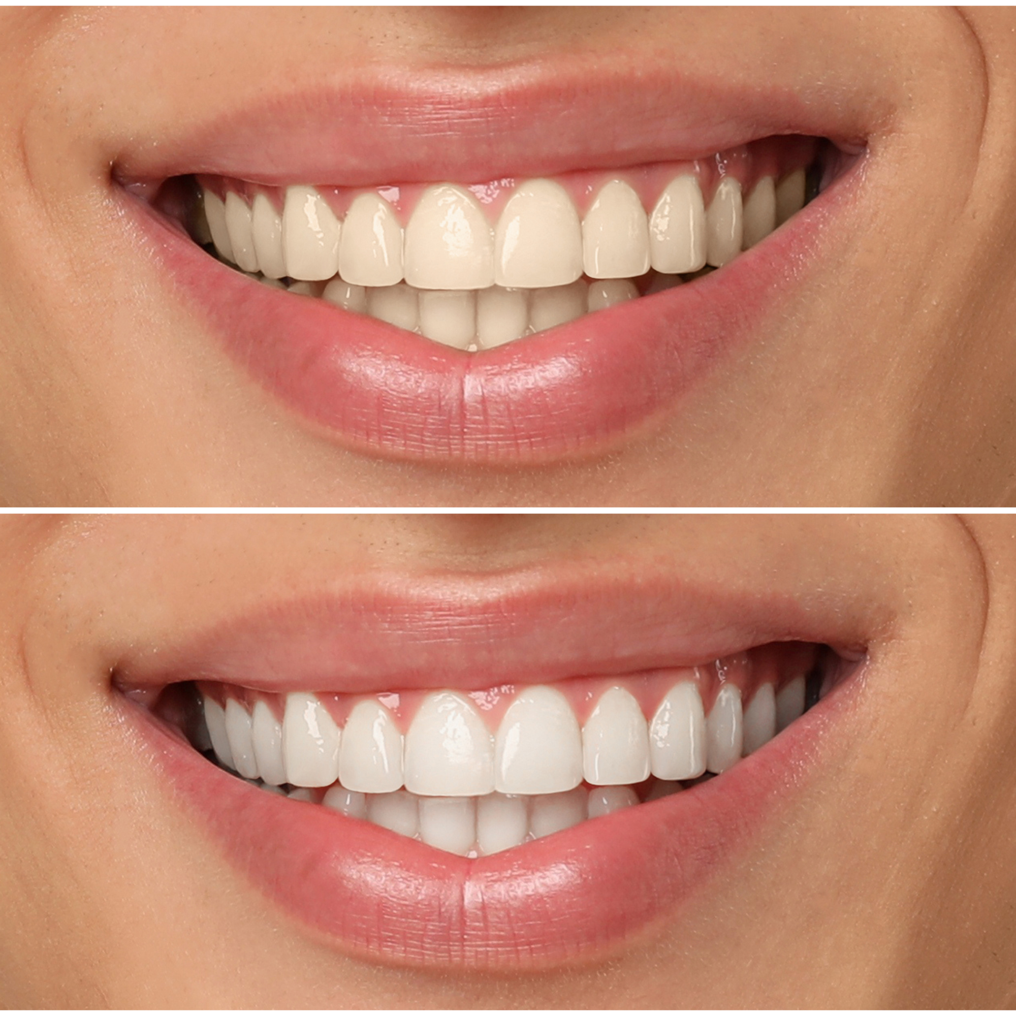Before/after transformation