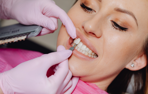 Beautiful Teeth with Veneers from the Best Dental Clinic in Walnut